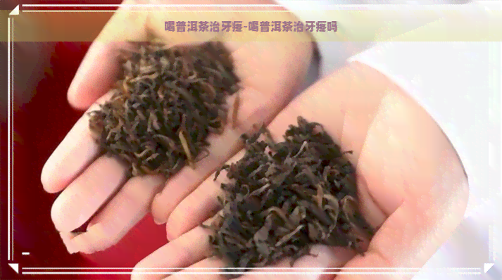 喝普洱茶治牙疼-喝普洱茶治牙疼吗