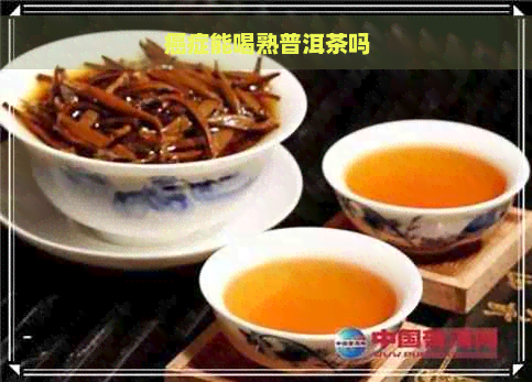 癌症能喝熟普洱茶吗