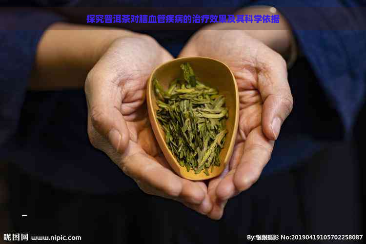 探究普洱茶对脑血管疾病的治疗效果及其科学依据