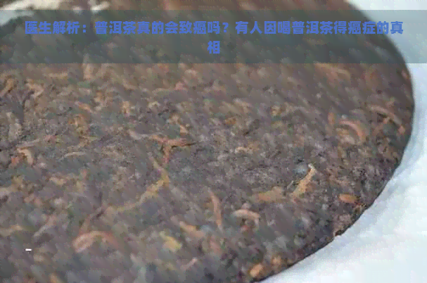 医生解析：普洱茶真的会致癌吗？有人因喝普洱茶得癌症的真相