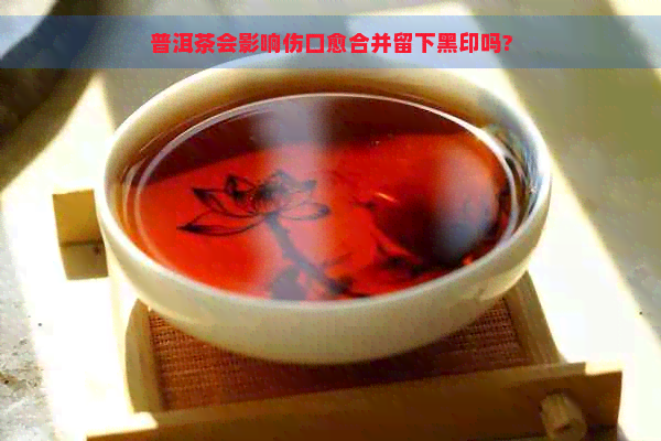 普洱茶会影响伤口愈合并留下黑印吗?