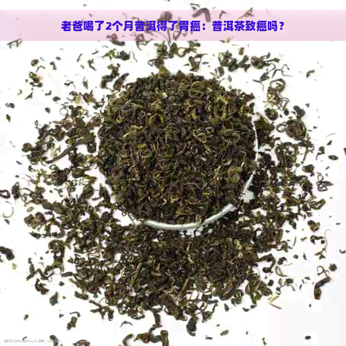 老爸喝了2个月普洱得了胃癌：普洱茶致癌吗？