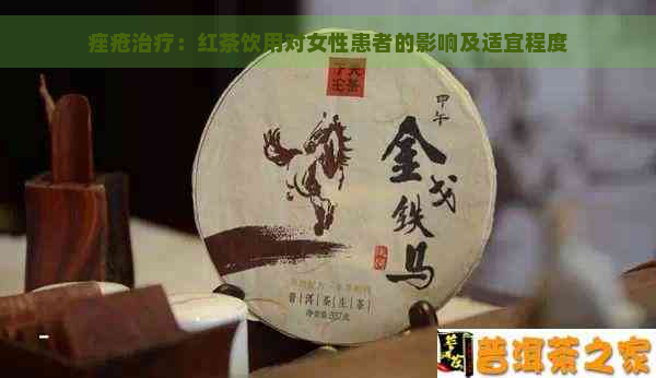 痤疮治疗：红茶饮用对女性患者的影响及适宜程度