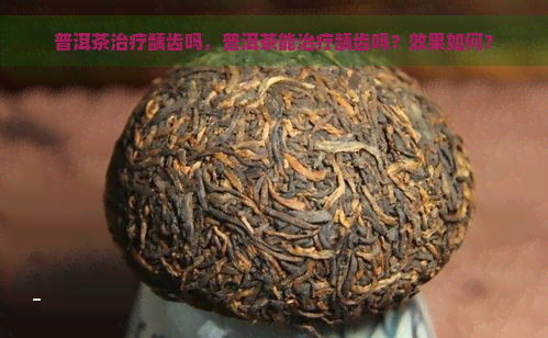 普洱茶治疗龋齿吗，普洱茶能治疗龋齿吗？效果如何？