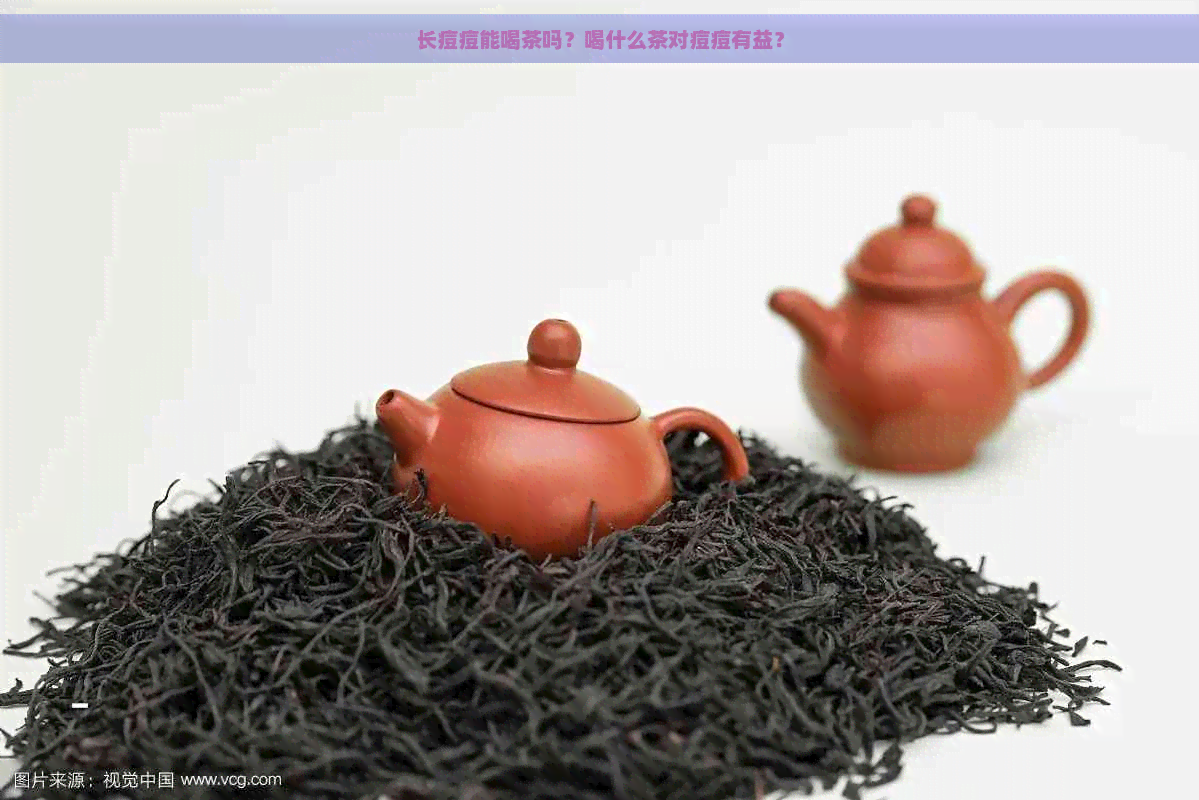 长痘痘能喝茶吗？喝什么茶对痘痘有益？