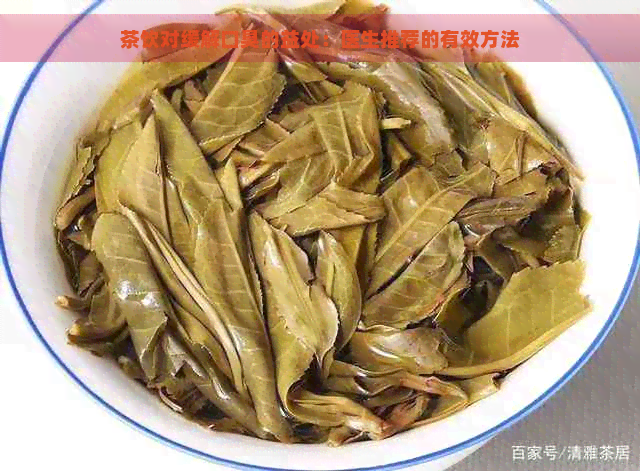 茶饮对缓解口臭的益处：医生推荐的有效方法