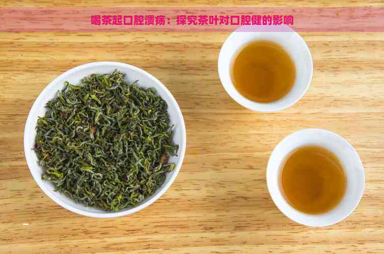 喝茶起口腔溃疡：探究茶叶对口腔健的影响