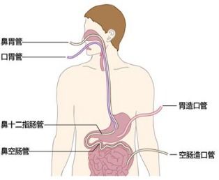 如何挑选干燕窝的各个部位以提升口感与营养：全面指南与推荐部位解析