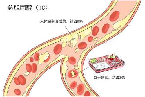 特定人群慎用：揭秘燕窝吸收障碍的真相