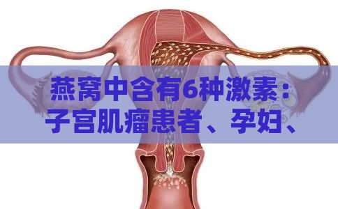 燕窝中含有6种激素：子宫肌瘤患者、孕妇、卵巢健康及怀孕影响解析