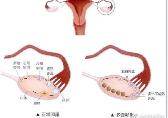 燕窝中含有6种激素：子宫肌瘤患者、孕妇、卵巢健康及怀孕影响解析