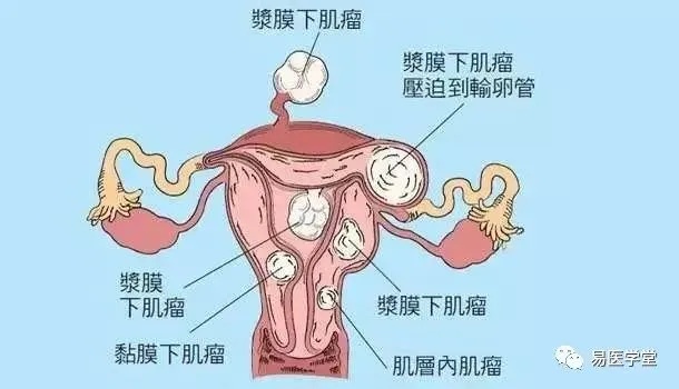 燕窝中含有6种激素：子宫肌瘤患者、孕妇、卵巢健康及怀孕影响解析