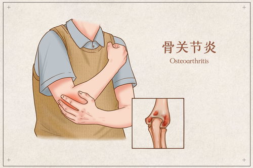 燕窝过敏：全面解析常见症状与应对措施