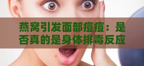 燕窝引发面部痘痘：是否真的是身体排反应？