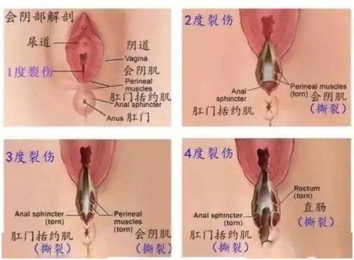 神经保护与修复：探究燕窝对神经功能的积极影响