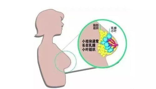 燕窝里有白块是什么原因引起的及这种现象的原因探究