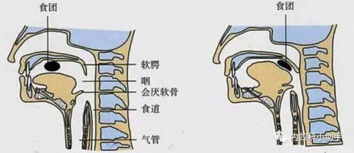 探究喝燕窝后不适的多种原因及解决方案