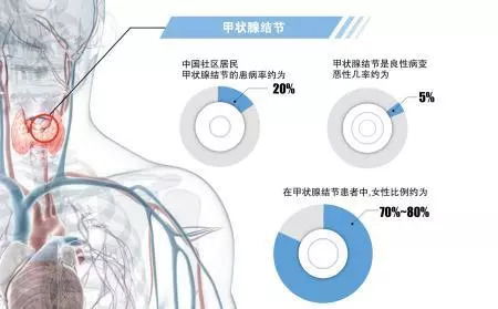 燕窝含碘量高吗：对甲状腺影响及食用建议