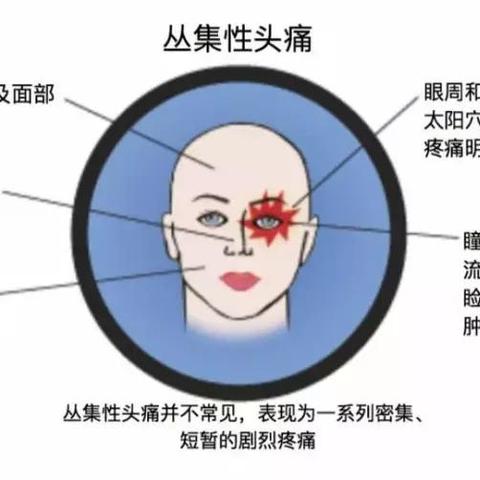 燕窝旁边疼痛的原因及可能症状分析