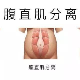 燕窝适合的人群：分类、作用及具体适宜人群概述